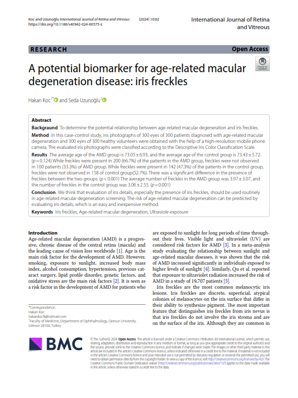 A potential biomarker for age-related macular
degeneration disease: iris freckles