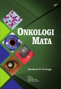 ONKOLOGI MATA